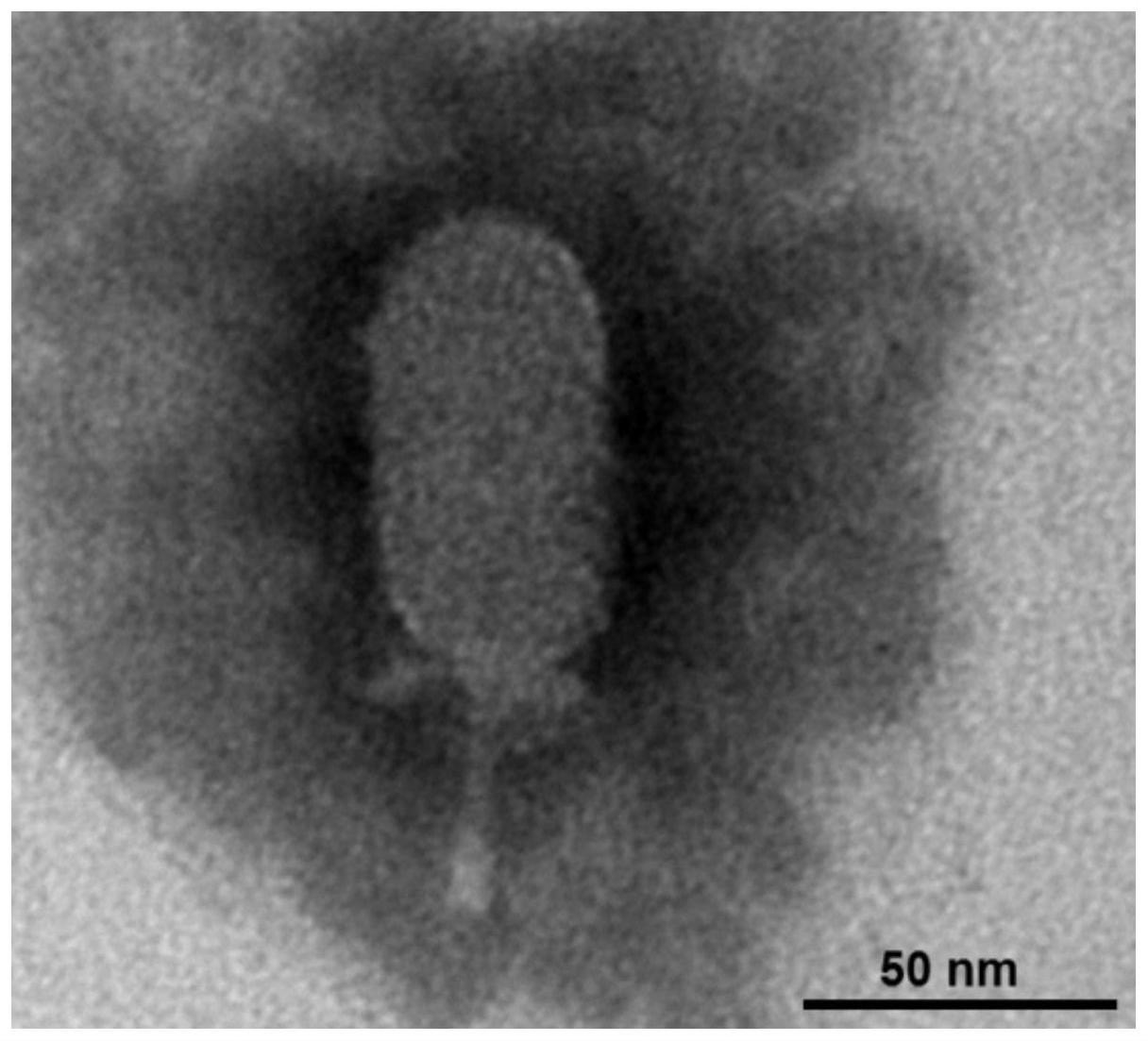 一种蜡样芽胞杆菌噬菌体及其应用的制作方法
