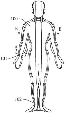 一种可穿刺型腕踝针人体教学模型的制作方法