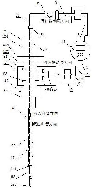 一种人体外周动脉腔内加压装置