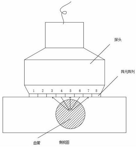 一种用于对血管检测的多普勒超声系统的制作方法