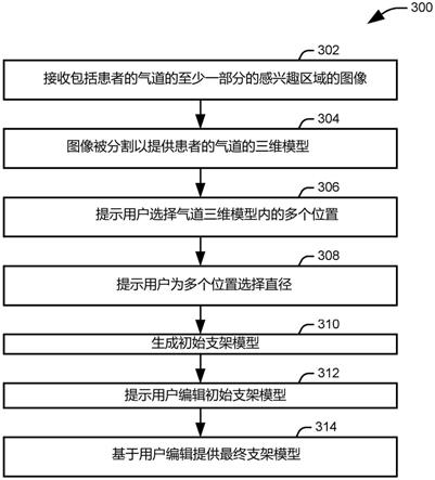 用于基于模型的支架设计和放置的系统和方法与流程