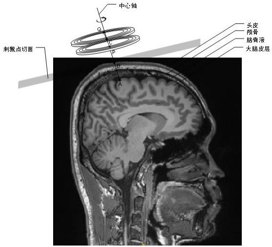 经颅磁导航定位系统和经颅磁刺激系统的制作方法