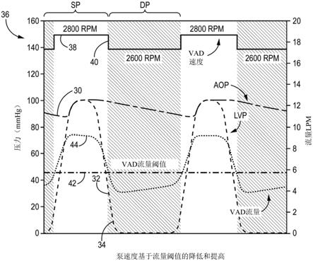 用于通过动态速度响应防止和解决左心室抽吸的血泵算法的制作方法