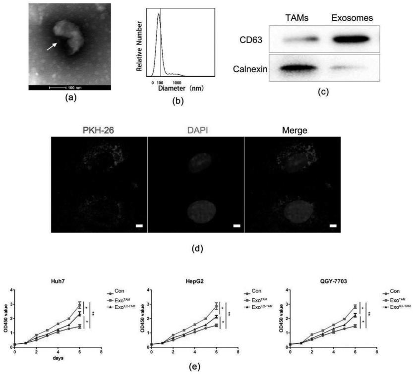 白细胞介素2调节肿瘤巨噬细胞生成的外泌体分泌成分抑制肝细胞癌的生长和转移方法与流程