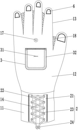 一種醫用約束手套的製作方法