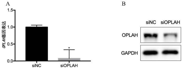 作用于OPLAH的siRNA、DNA及构建物和应用