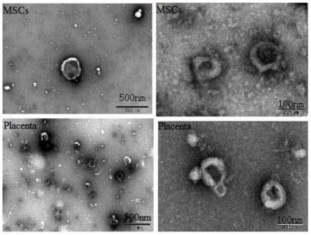 胎盘外泌体的提取方法及应用与流程