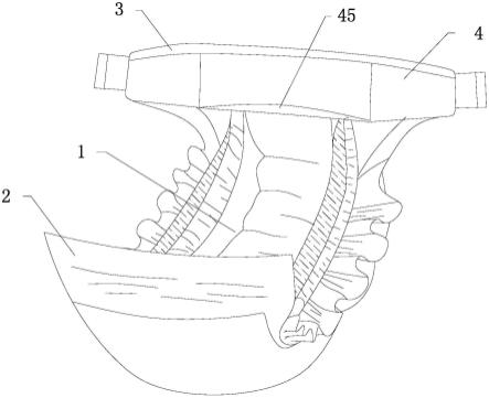 一种扩展型防后侧漏腰围纸尿裤的制作方法