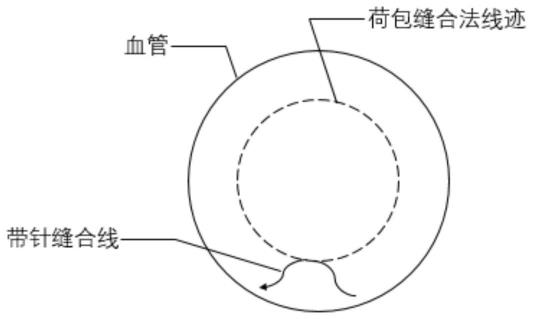 人工分支型血管及其制备方法与流程