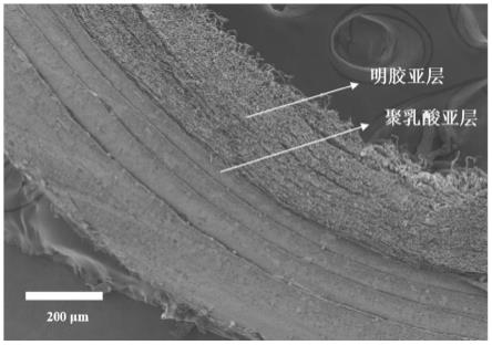 一种管状支架及其制备方法与应用与流程