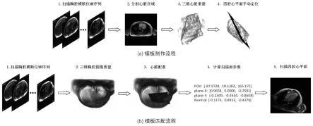 一种基于模板匹配的心脏四腔心自动定位方法