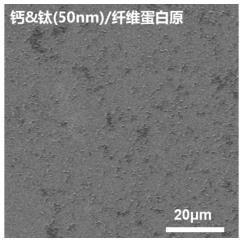 一种可植入抗菌涂层及其制备方法以及应用