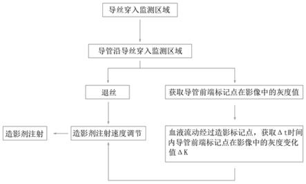 一种用于肾动脉射频消融术的血管造影系统的制作方法