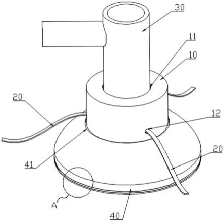 T组合复苏面罩固定器的制作方法