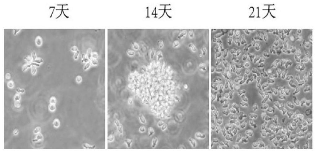 一种冻存脐带血Treg细胞的体外扩增方法与流程