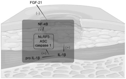 FGF21调控糖尿病缺血创面细胞焦亡的机制的应用