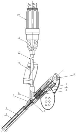 一种耐高压型防针刺留置针的制作方法