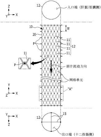 胆管支架及其制作方法