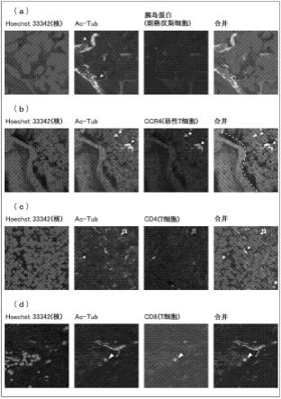 T细胞淋巴瘤的指标的检测方法及其应用