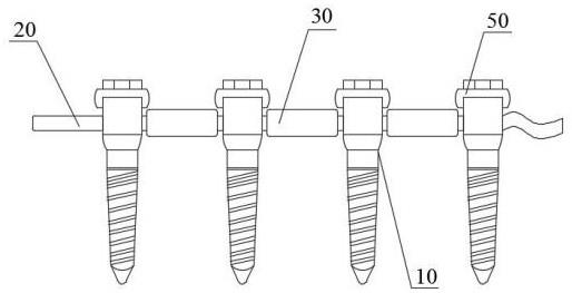 一种用于脊柱侧凸微创手术的椎体系绳设备及其使用方法