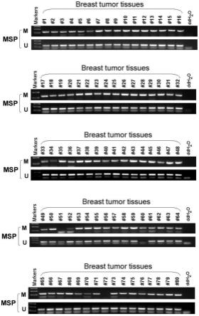 乳腺癌生物标志物ZNF662基因及其检测方法与应用