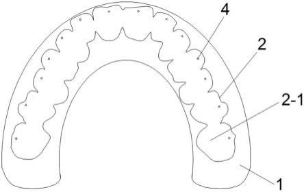 一种牙齿修复的辅助模具的制作方法