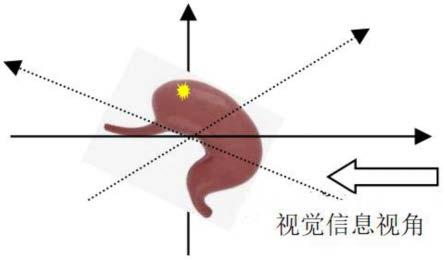 一种用于定位病灶的腔镜手术导航定位系统的制作方法