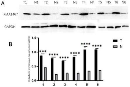 KIAA1467基因的用途