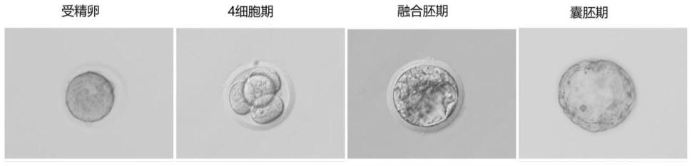 一种透明质酸钠双相凝胶及其应用