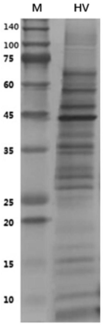 一种结核分枝杆菌蛋白组、其筛选方法及其应用与流程