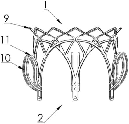 一种短构型二尖瓣瓣膜支架的制作方法