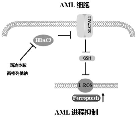 一种预防和/或治疗急性髓系白血病的联合用药物组合物及其应用的制作方法