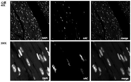 一种可识别核微丝结构的nAC荧光探针小鼠模型及其应用