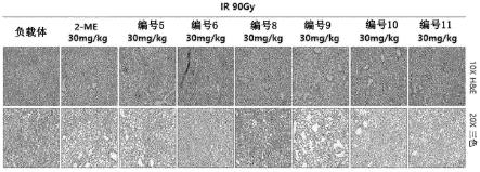 2-甲氧基雌二醇衍生物及其医学用途