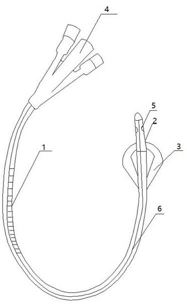 三腔尿管原理图图片