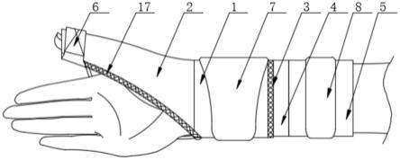 一种便于佩戴的术后纠正护腕的制作方法