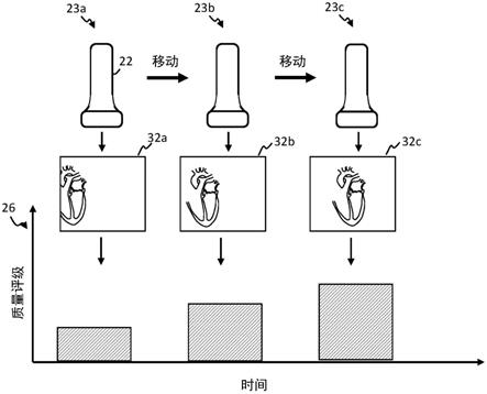 超声引导方法和系统与流程