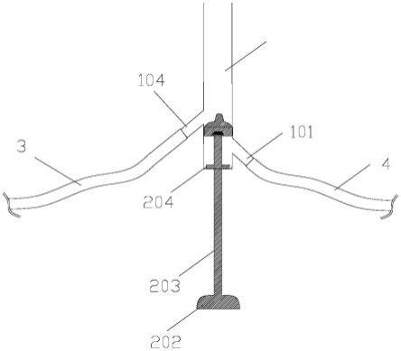 一种结肠透析用灌洗管的制作方法