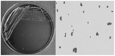 具有良好抗氧化抗炎效果的表皮葡萄球菌及其应用的制作方法