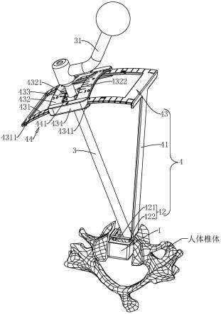 一种颈椎前路置钉导向器的制作方法