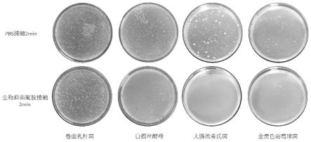 一种平衡妇科微生态菌群结构的生物抑菌凝胶的制作方法