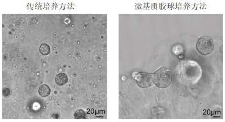 一种利用微基质胶球快速培养类器官的方法与流程