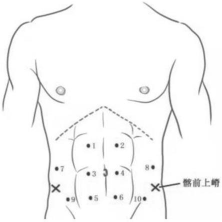 一种腹壁肌群自发放电信号的采集评估方法及应用与流程