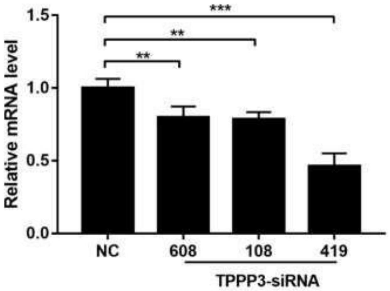 TPPP3作为作用靶点在制备I型超敏反应药物中的应用的制作方法