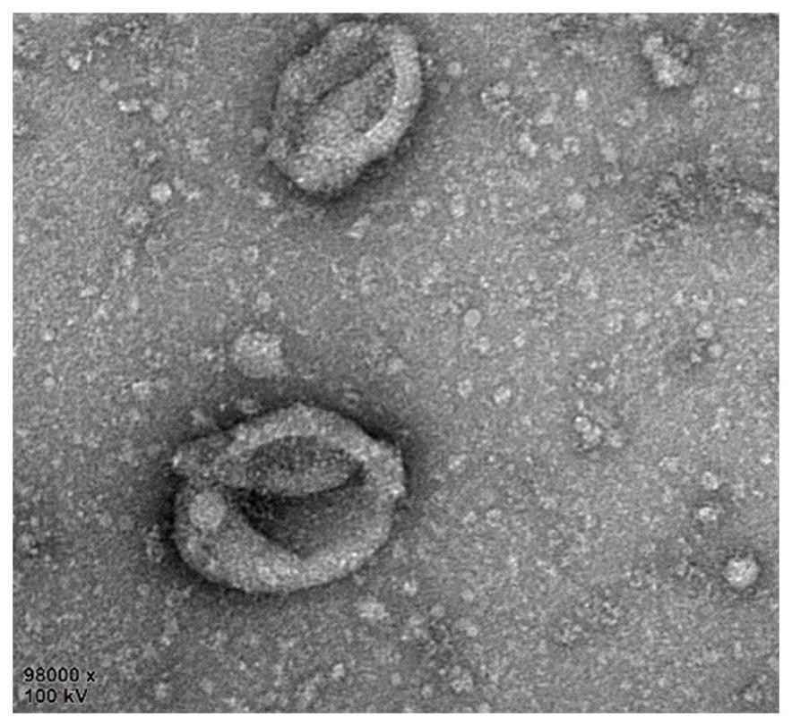 一种外泌体冻干粉及其制备方法、应用与流程