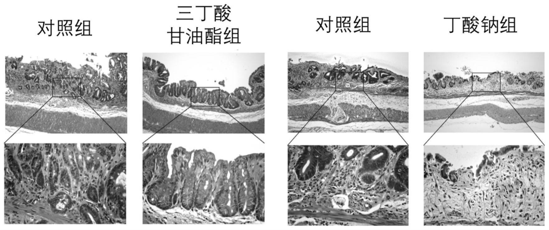 三丁酸甘油酯及其衍生物在制备预防和/或治疗放疗引起的消化道并发症药物中的应用