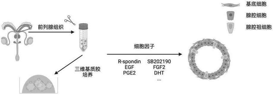 小鼠前列腺类器官制备方法及原发原位前列腺癌动物模型