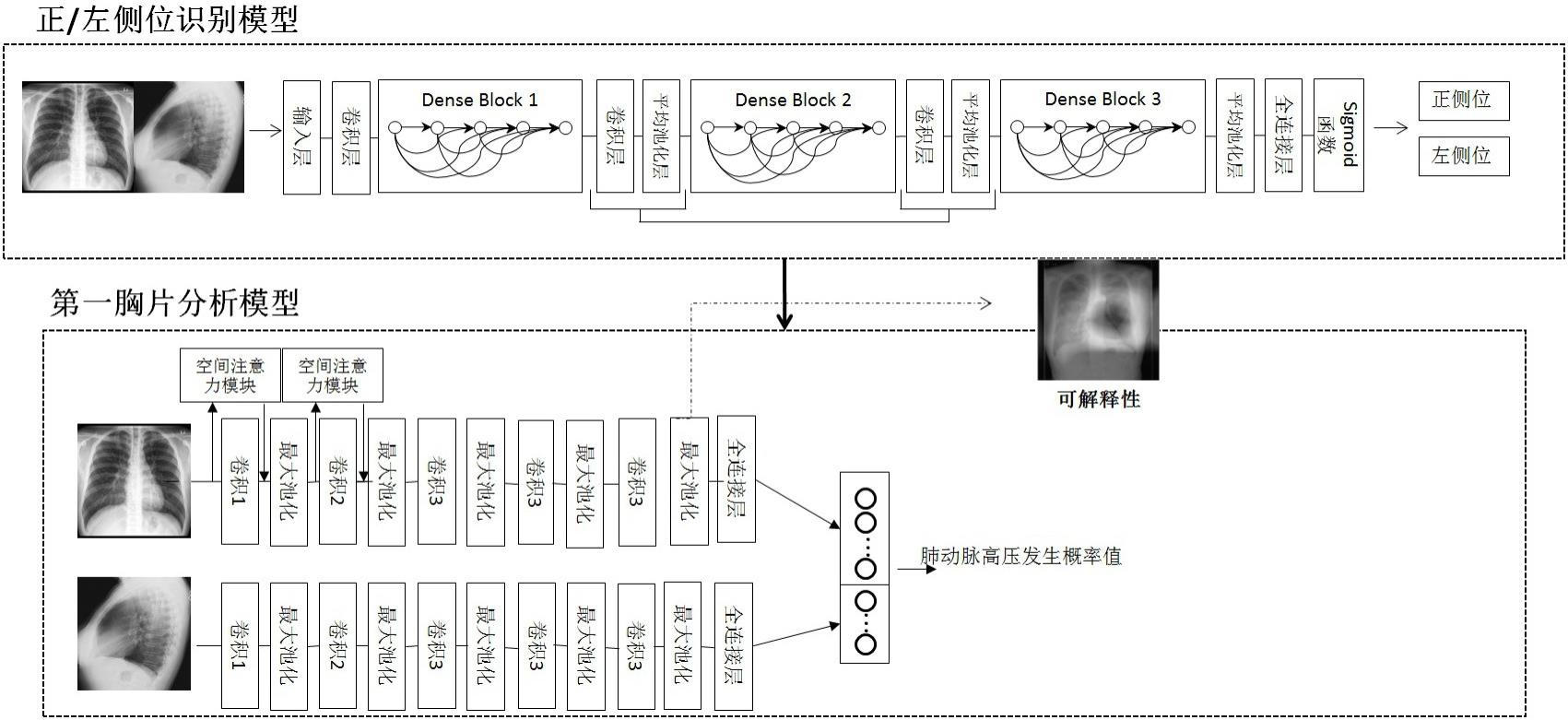 基于双视图胸片的肺动脉高压发生概率的确定方法及系统