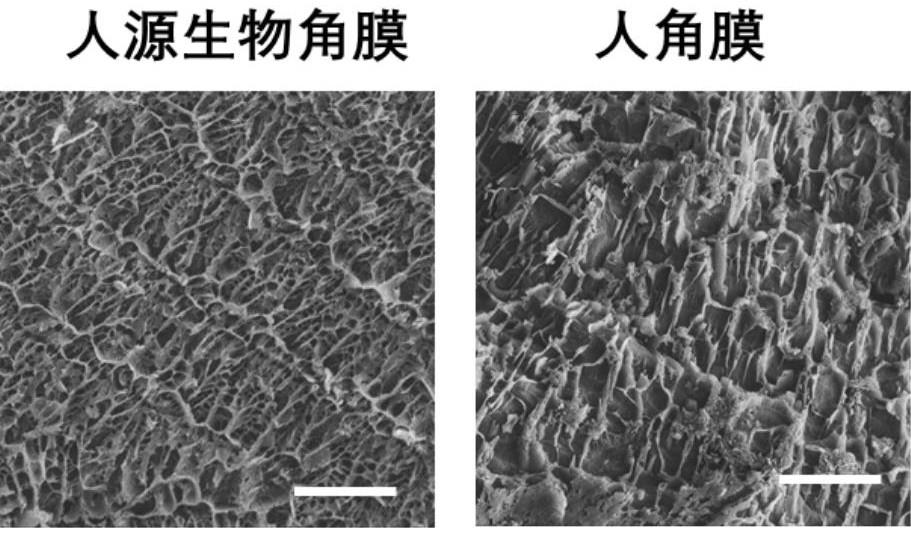 一种人源生物角膜基质的制备方法和应用