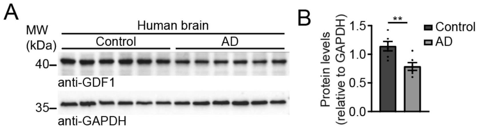 GDF1